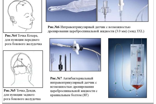 Кракен наркокортель